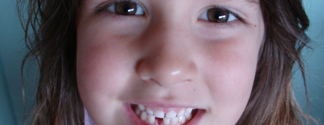 Leczenie zębów u dzieci Olsztyn