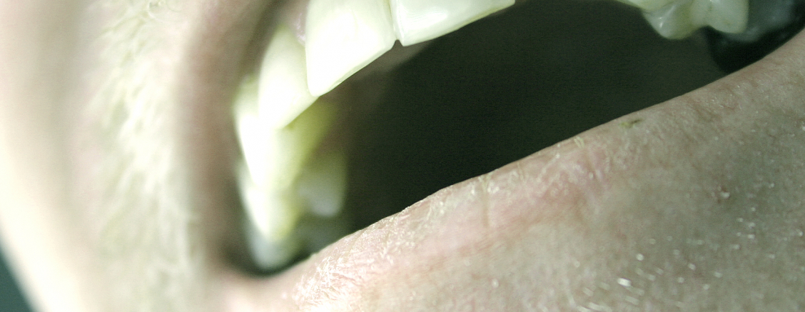 Leczenie bólu zęba Olsztyn