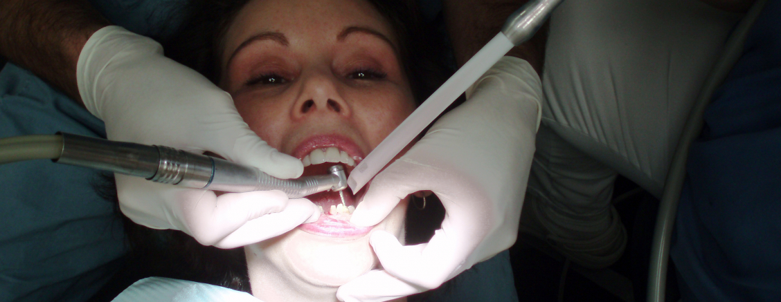 Szybkie leczenie zębów Opole